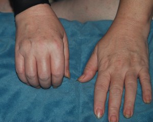 2010-05-18 CRPS Pics 2