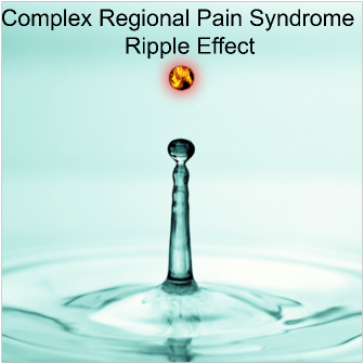 Complex Regional Pain Syndrome’s (CRPS’s) Ripple&nbsp;Effect